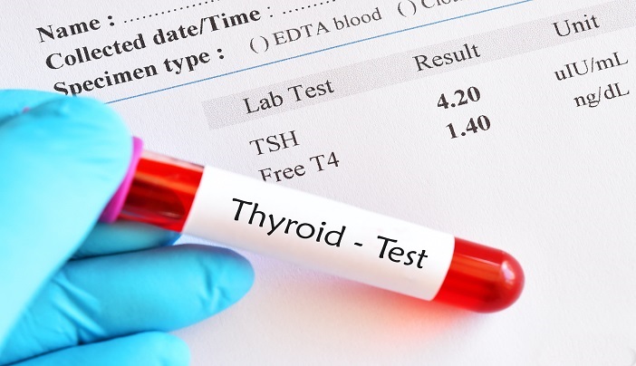 Thyroid PANEL