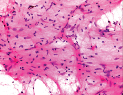 CYTOPATHOLOGY